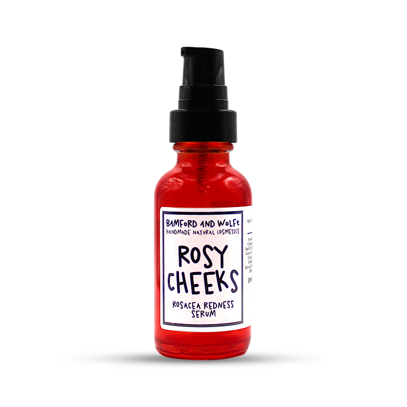 ROSY CHEEKS